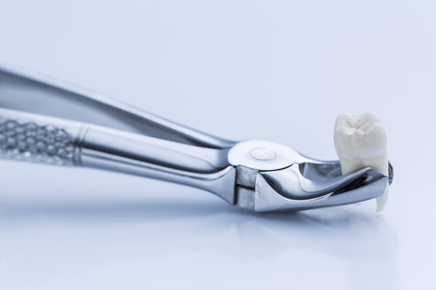 Wisdom Teeth Removal
